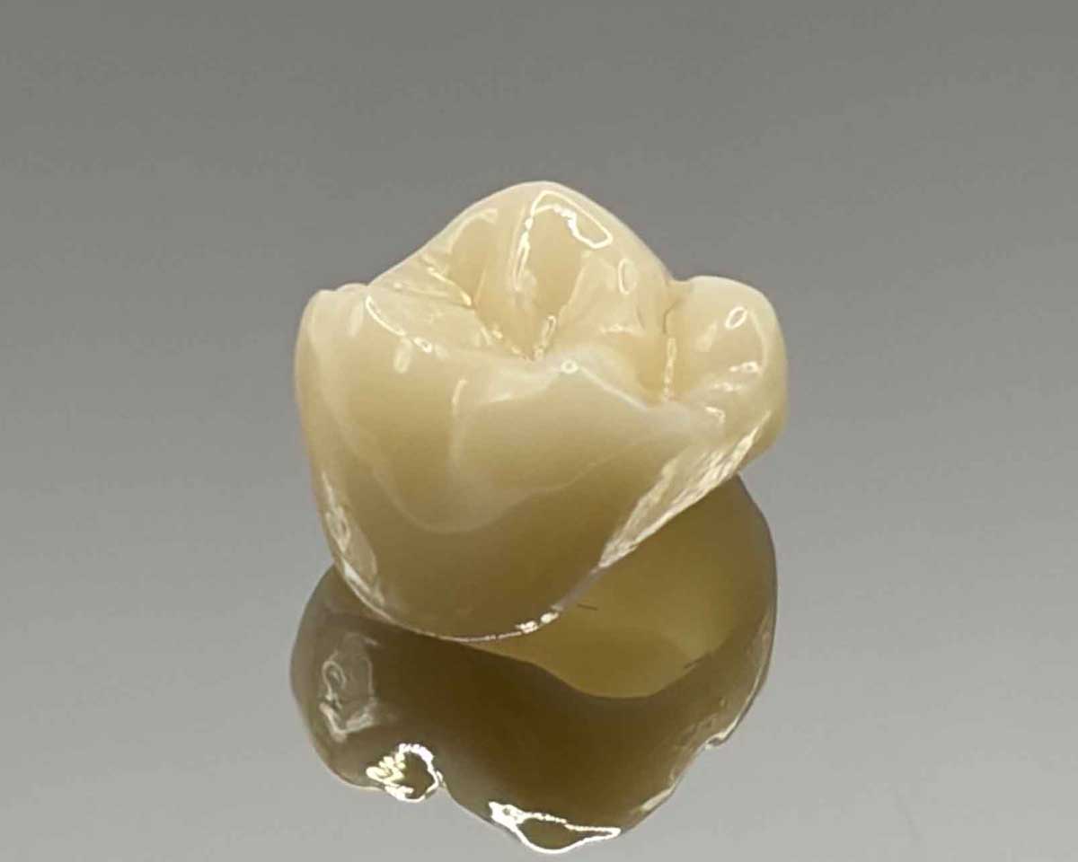 Close-up of dental crown reflecting on surface at Whittier Palm Dental in Montebello, CA